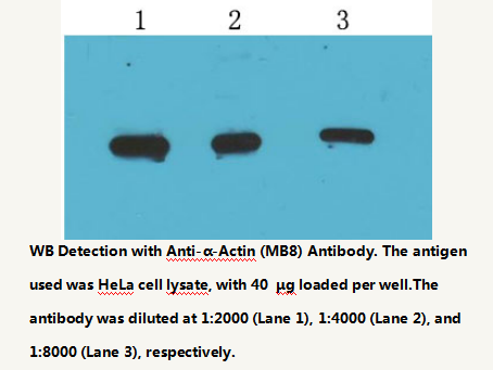 Anti-&alpha;-actin Mouse Monoclonal Antibody