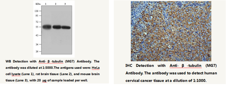 Anti-&beta;-tubulin Mouse Monoclonal Antibody